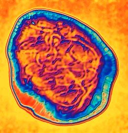Measles virus (Alfred Paseka/Science Photo Library)